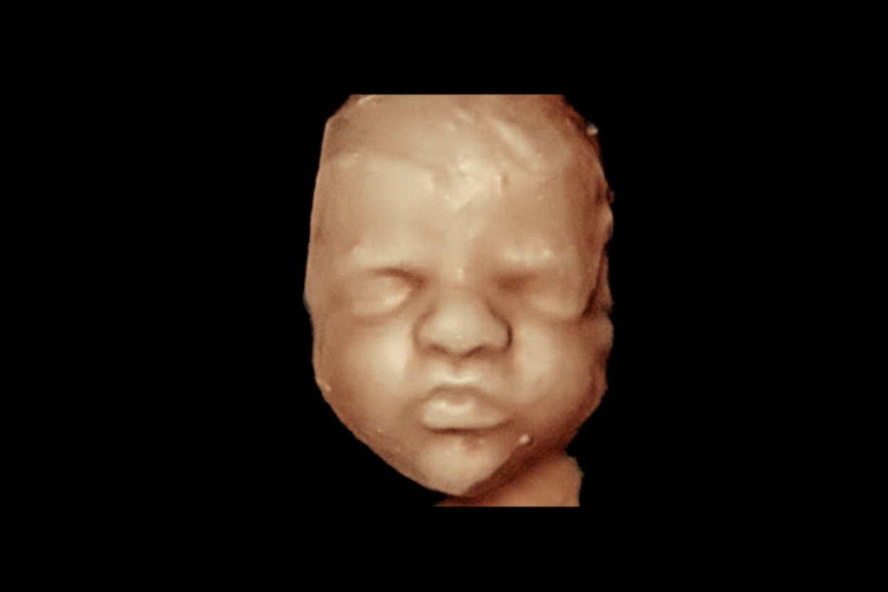 Échographie 3D · visage